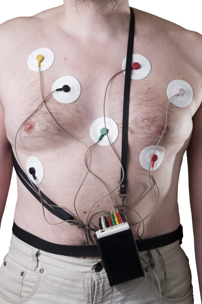 holter monitor test Sydney