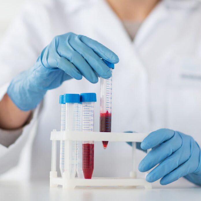 Live Blood Analysis Melbourne